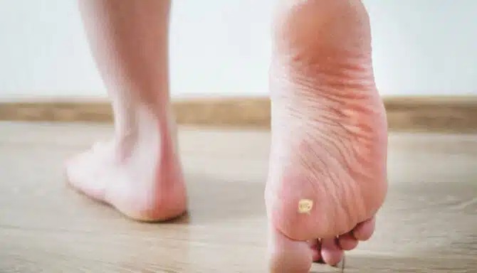 ಚಳಿಗಾಲದಲ್ಲಿ ಬರಿಗಾಲಿನಲ್ಲಿ ನಡೆಯುವುದು ಹಾನಿಕಾರಕವೇ?